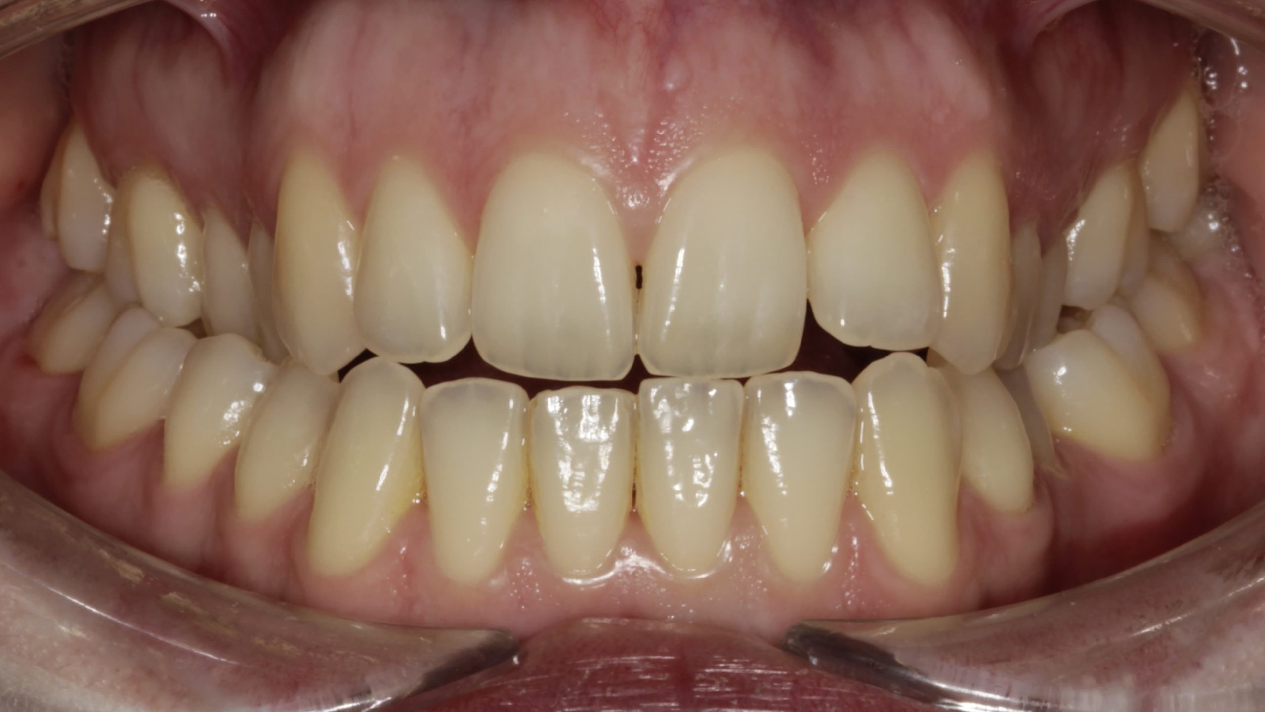 Before image